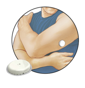 illustration of person with wearable device on arm